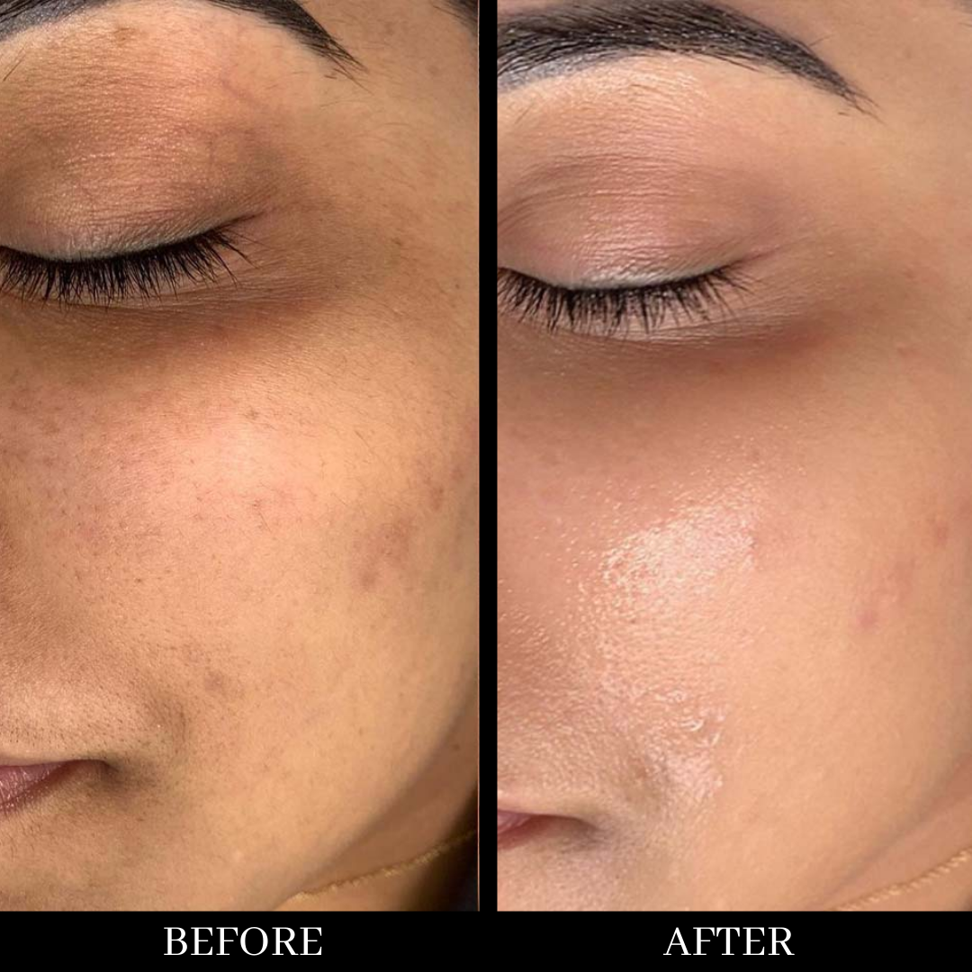 Glycolic acid serum 1%